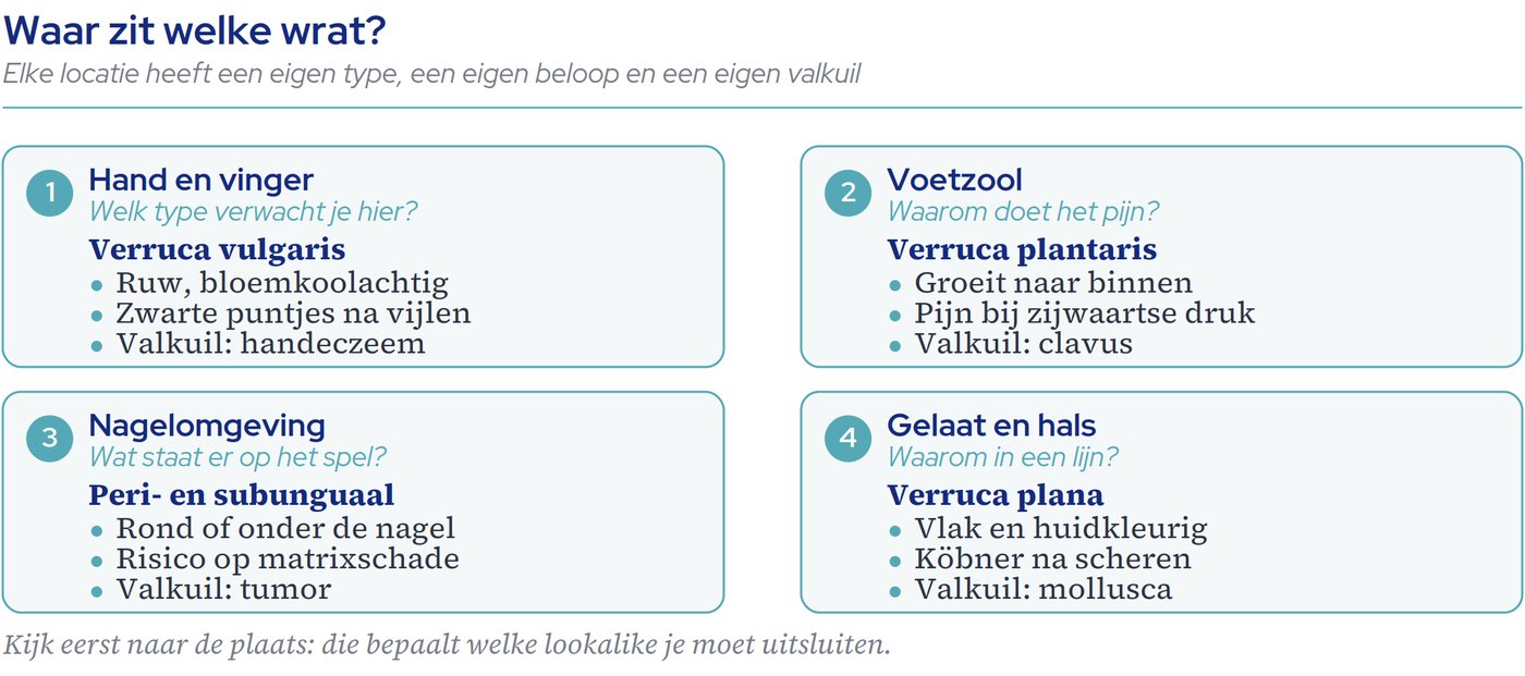 Vier locaties