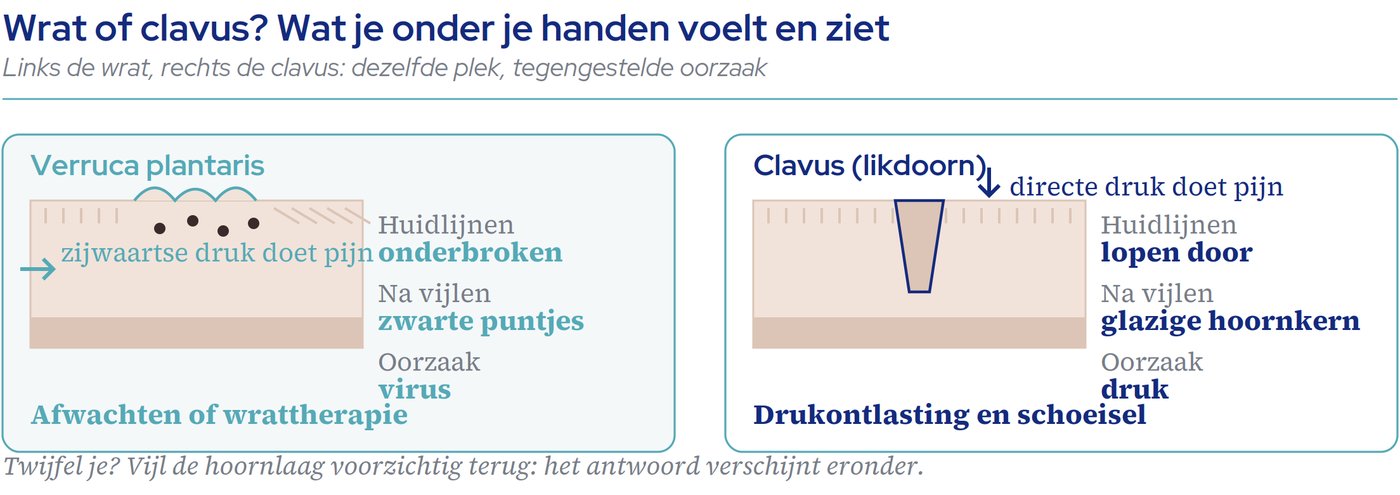 Wrat of clavus