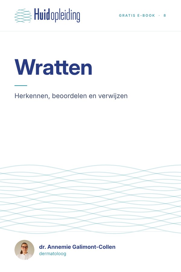 Kaft Wratten